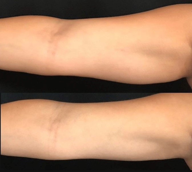 V-FORM B&A (3) V-FORM B&A (3)